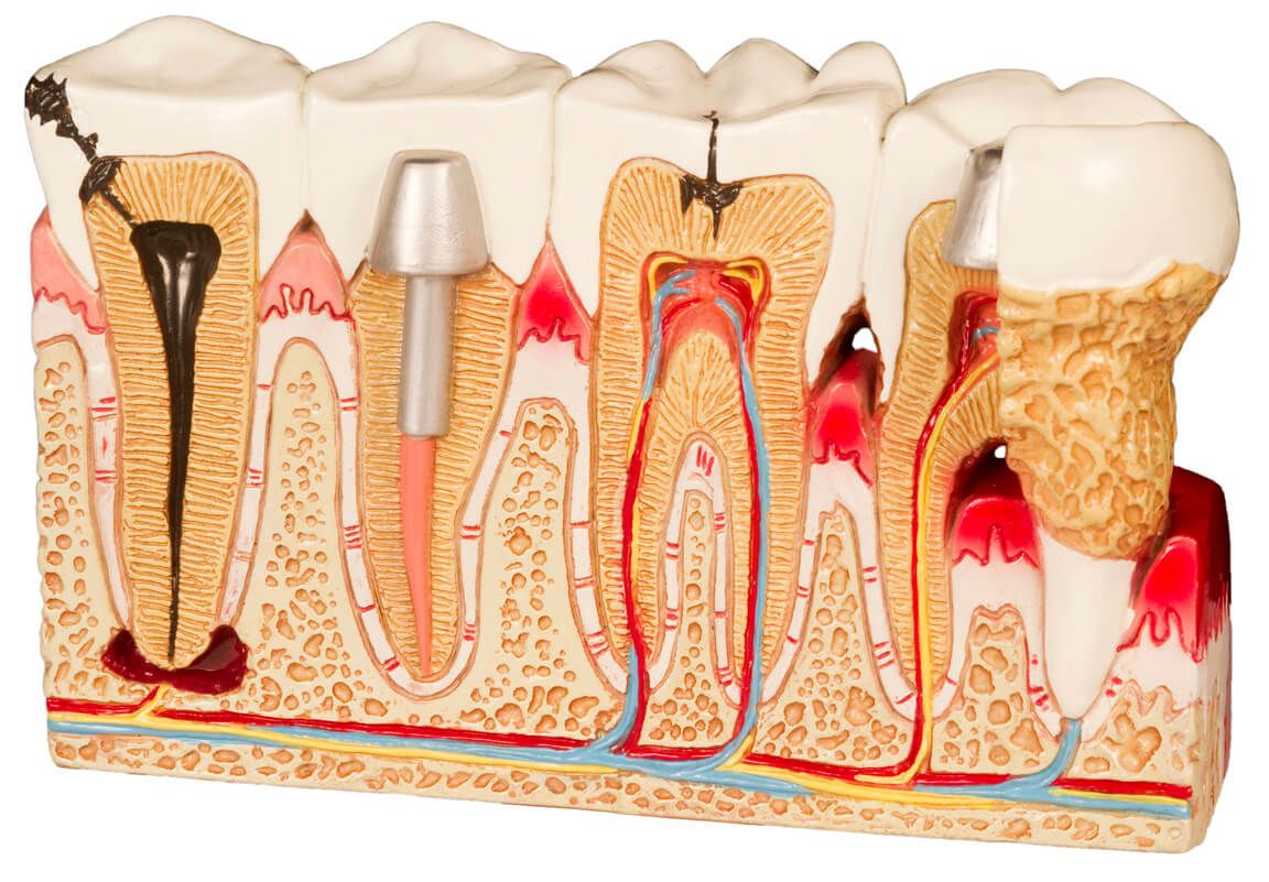 Soins complets des pathologies dentaires